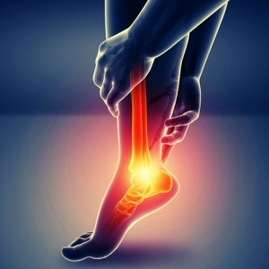 Heel Pain Solution